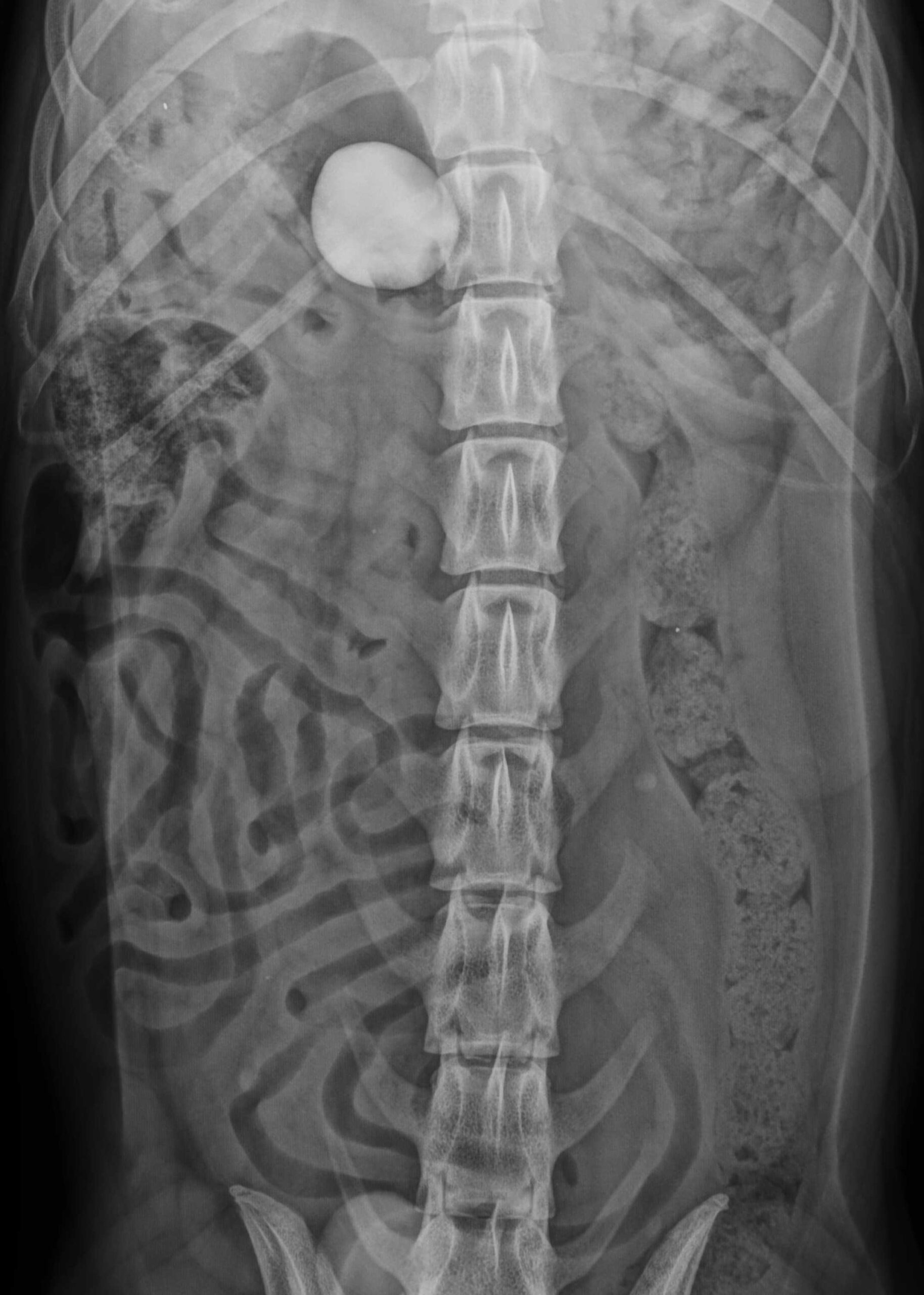 Röntgenbild eines Golden Retrievers mit verschlucktem Stein im Magen. @Tierklinik Ismaning