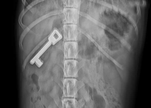 Riesenschnauzer Paco verschluckt Schlüssel Röntgenbild Bauchraum von oben
