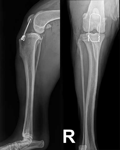 Rüntgenbild einer Drahtcerclage post OP nach Patellasehnenriss Hund
